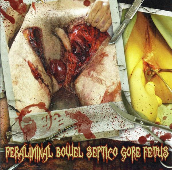 Dead Fetus Collection / Gore / Septicopyemia / Feraliminal Lycanthropizer / Bowel Stew - Feraliminal Bowel Septico Gore Fetus (Split)
