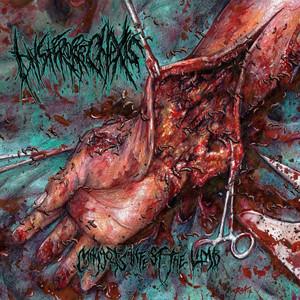 Hysterorrhexis - Maggots Infest The Limb