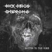 Sick Sinus Syndrome - Rotten To The Core