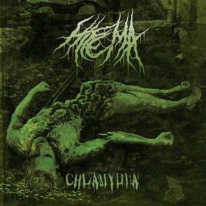 Hifema - Chlamydia (Demo)