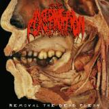 Anatomical Plastination - Removal The Dead Flesh (EP) (Lossless)