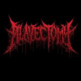 Alavectomy - Demo 2025 (Demo)