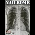 Nailbomb - Live At Dynamo (DVD)