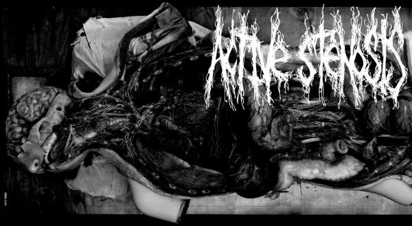 Active Stenosis - Discography (2010 - 2015)