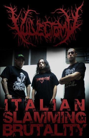 Vulvectomy - Abusing Dismembered Beauties (Lossless)