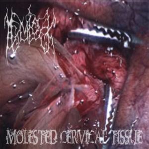 Hemlock - Molested Cervical Tissue (Demo)