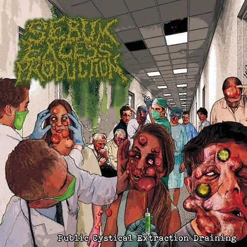 Sebum Excess Production - Public Cystical Extraction Draining