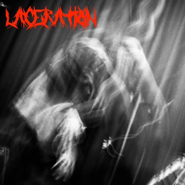 Laceration - Laceration