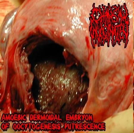 Chainsaw Invagination - Amoebic Dermoidal Embryon of Oocytogenesis Putrescence (Demo)