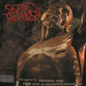Septic Autopsy - Contaminated Festering Gore From Acts Of Degradation & Pulsating Rot