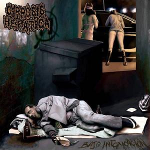 Cirrosis Hepatica - Bajo intoxicacion