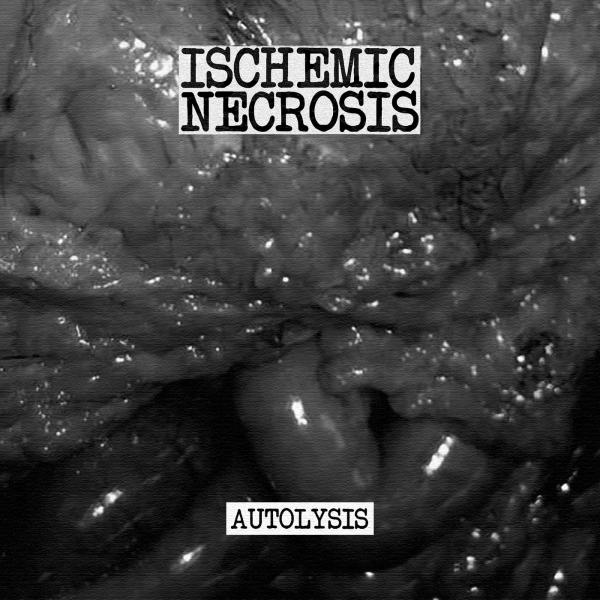 Ischemic Necrosis - Autolysis (EP)