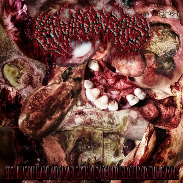 Paedogoretopsy - Pedophiliac Defilement And Cadaveric Extirpation Of Brutalized Child Genitalia Remnants (EP)