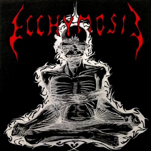 Ecchymosis - Ecchymosis