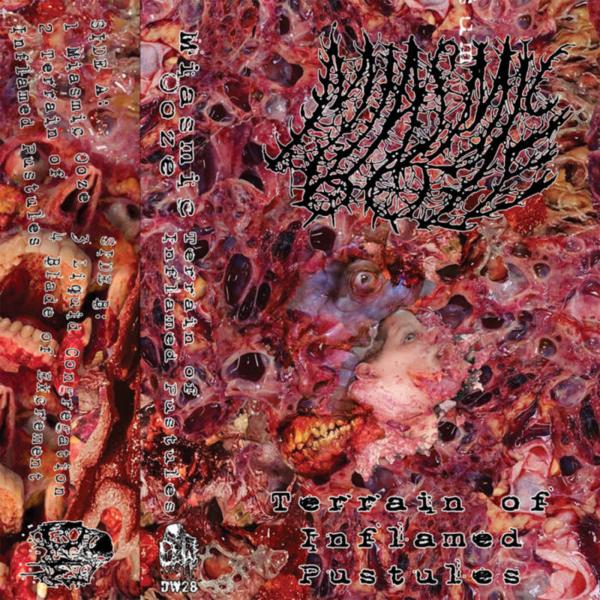 Miasmic Ooze - Terrain Of Inflamed Pustules (EP)