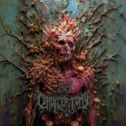 Cordyceptomy - Cordyceptomy