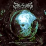 Symphysiotomy - Dissolution Of The Body In Acid - Promo (Demo)