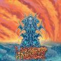 Laparotomy - Laparotomy (EP)